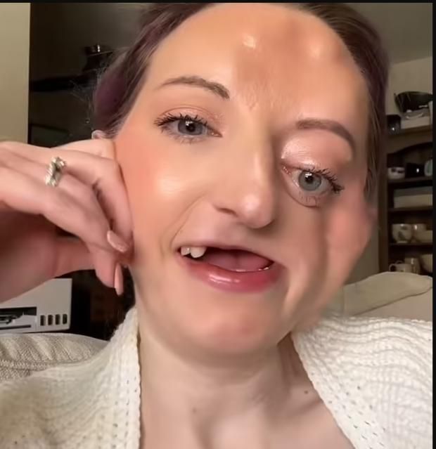 علامة في الفك تشير إلى الإصابة بسرطان مميت.. تعرف عليها