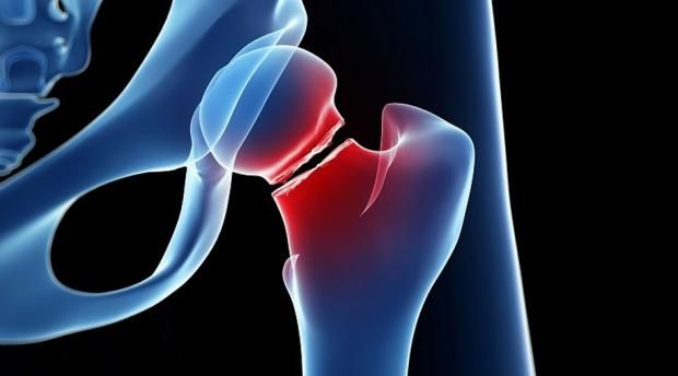 بعد إصابة نجوى فؤاد في ذراعها.. نصائح لتسريع التعافي وتفادي المضاعفات