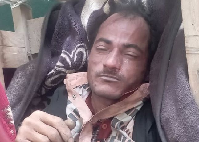 وفاة شاب إثر سقوطه في بئر بالسبرة شرقي إب