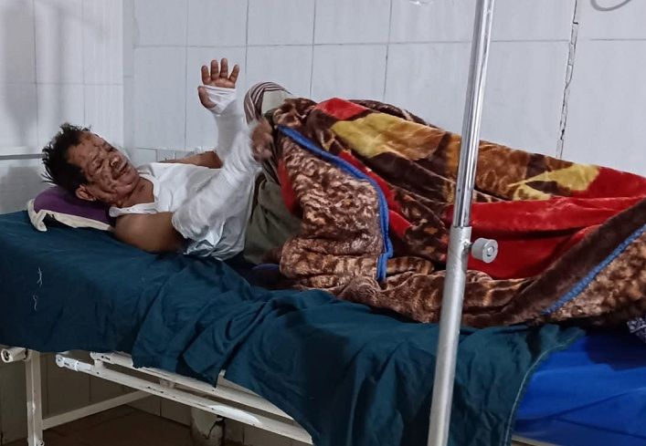 إب..مليشيا الحوثي تتخلى عن علاج "بائع الزلابيا" وتقوم بملاحقة موثقي حادثة الاعتداء