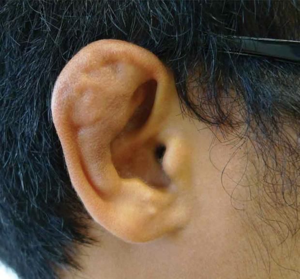 منطقة في الجسم مهددة بأخطر أنواع سرطان الجلد.. تتعرض للشمس باستمرار