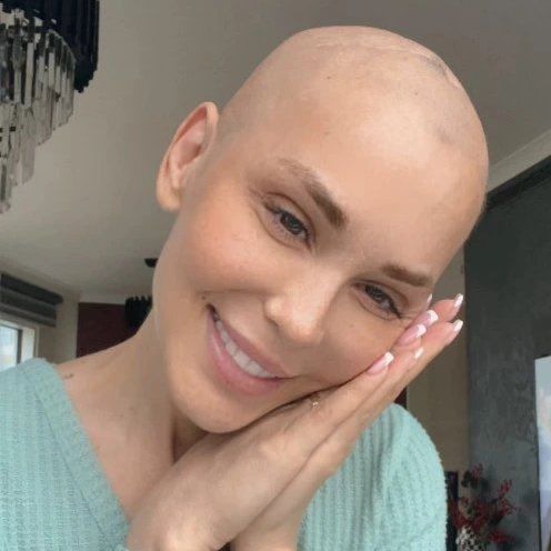 المغنية التركيّة شيمال خسرت معركتها ورحلت عن عمر تسعة وثلاثين عامًا