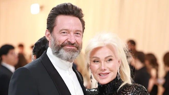 بعد الطلاق .. كيف ستُقسم ملايين هيو جاكمان وديبورا لي فورنيس