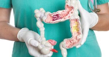 ممارسة الرياضة تقلل خطر عودة سرطان القولون بعد العلاج