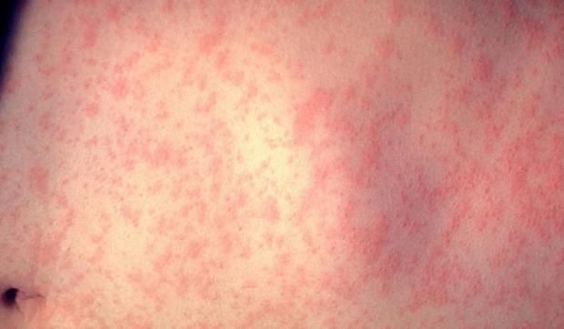 فاكهة صيفية تعزز الذاكرة وتحمي خلايا الدماغ من التلف.. تناولها يوميا