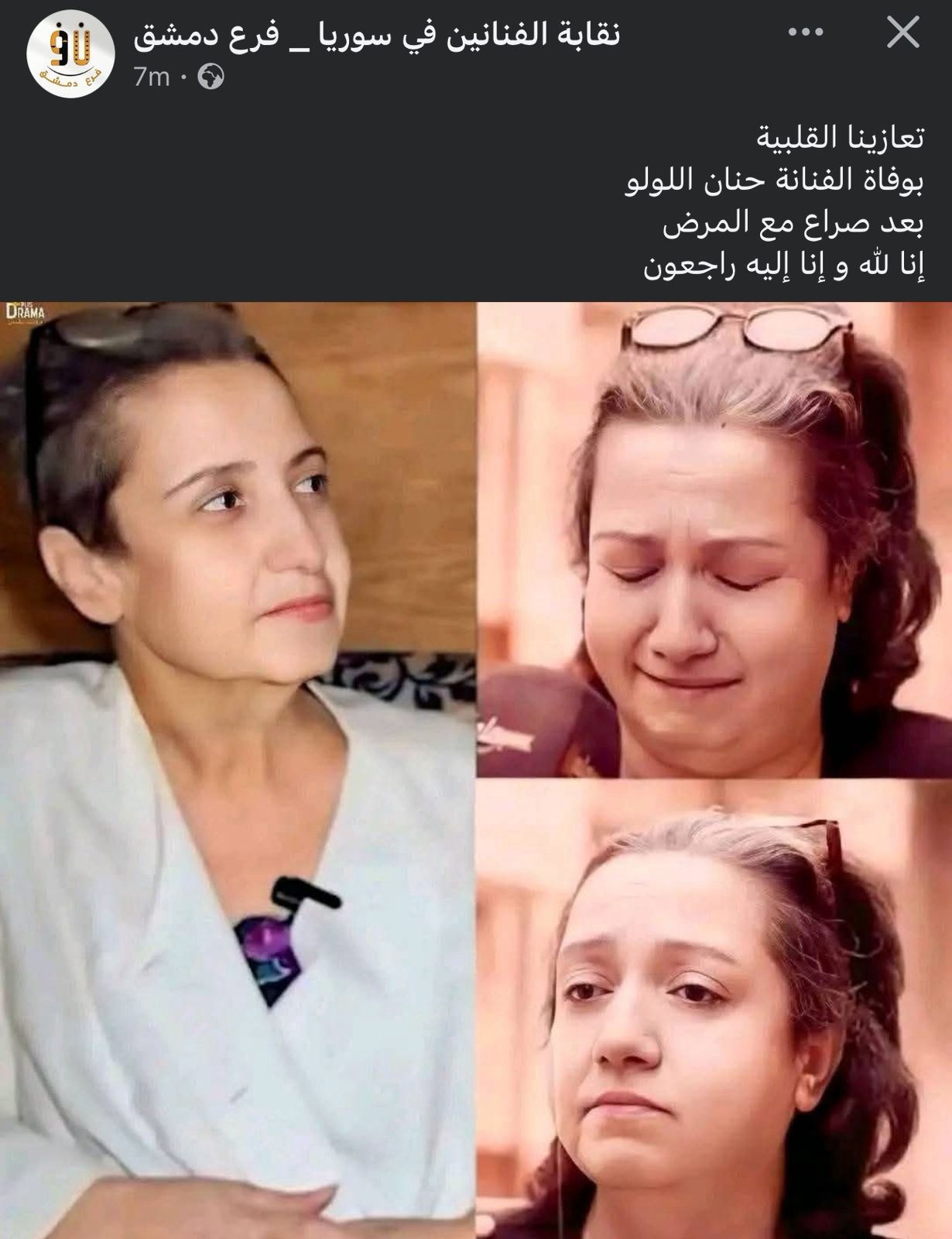 وفاة الفنانة السورية حنان اللولو بعد صراع مع مرض السرطان