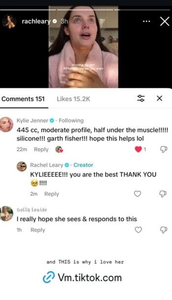 في تصريح جريء.. كايلي جينر تعترف بخضوعها لعملية تكبير للصدر