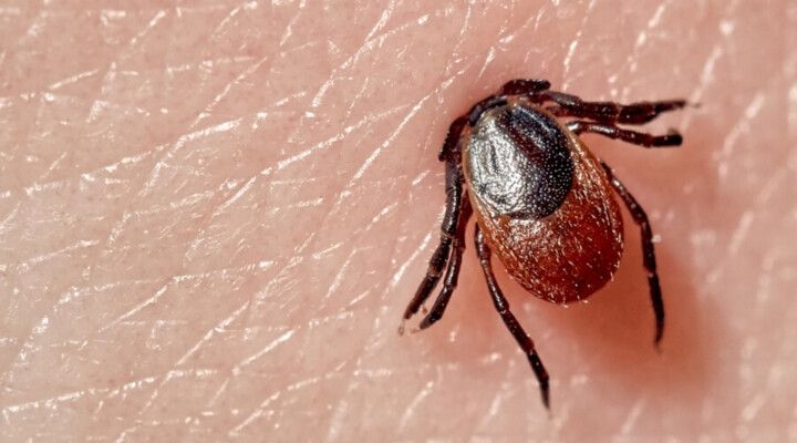 لدغة قرادة تنقل ممثلة تركية شهيرة إلى المستشفى