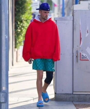 جاستن بيبر يقلق محبيه بظهوره مصابًا