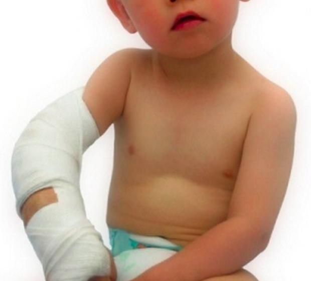 قبل فوات الأوان.. كيف تكتشف إصابة طفلك الرياضي؟