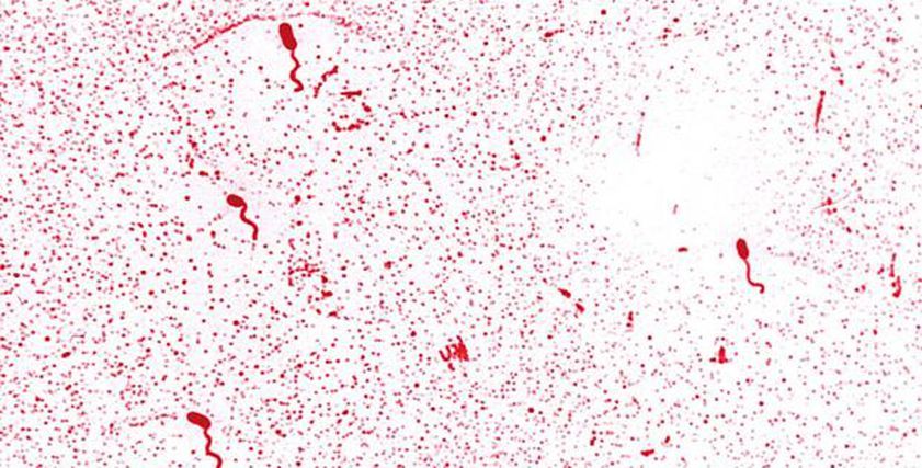 تسجيل 79 حالة إصابة.. انتشار بكتيريا تهدد الحياة في أمريكا بسبب بيض المزارع