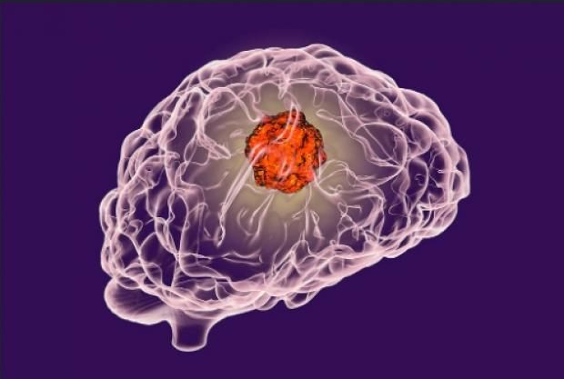 مخاطر الوظائف المرهقة.. قد تسرق قدرتك على اتخاذ القرار