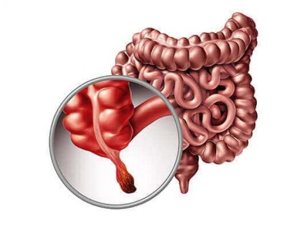 ورم نادر يهدد جيل الألفية.. ينتشر أسرع من سرطان القولون