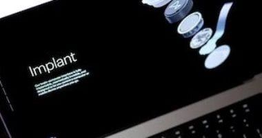 تكنولوجيا: نيورالينك تطور شريحة دماغية تمكّن قردًا من "رؤية" أشياء غير موجودة