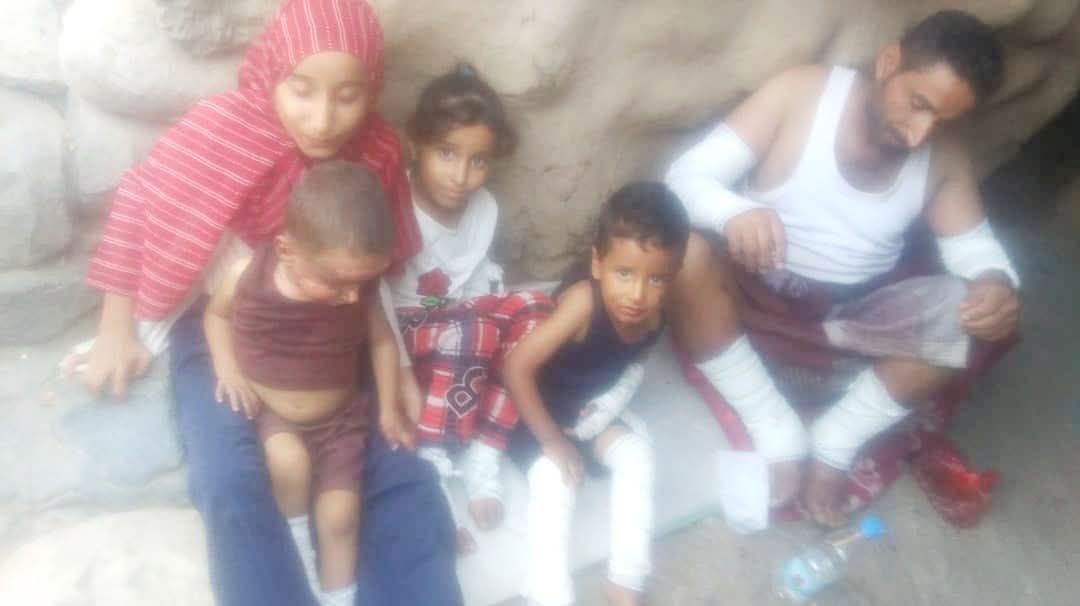 إب.. انفجار أسطوانة غاز يتسبب باحتراق أسرة كاملة في مديرية القفر 