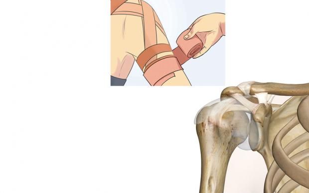 بعد إصابة إمام عاشور.. ما مخاطر كسر الترقوة وموعد العودة؟