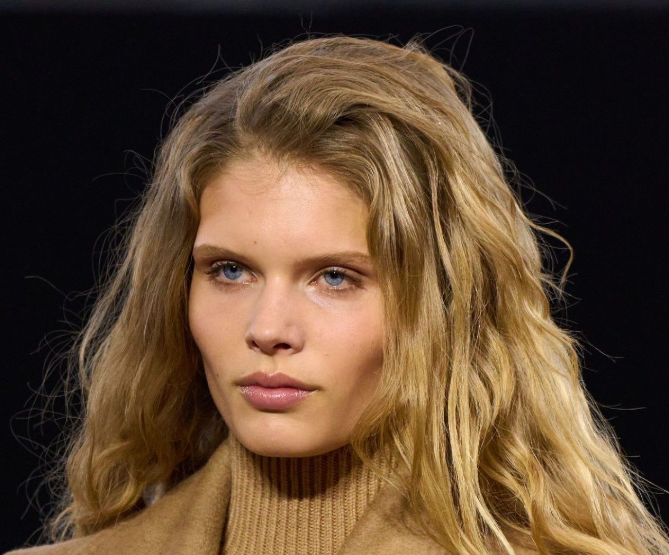 تجربتي مع حقن البلازما للشعر.. خصلاتي أصبحت أكثر نمواً وكثافة