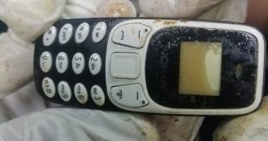 هاتف فى معدة مريض منذ عامين.. واقعة طبية نادرة بمستشفى الأزهر في أسيوط