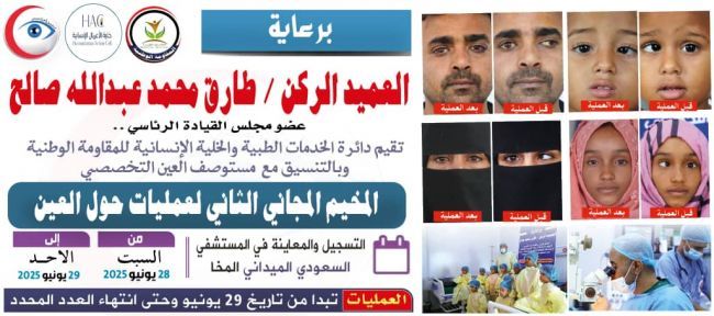 برعاية العميد الركن طارق صالح..الإعلان عن المخيم المجاني الثاني لجراحة حول العين في المخاء