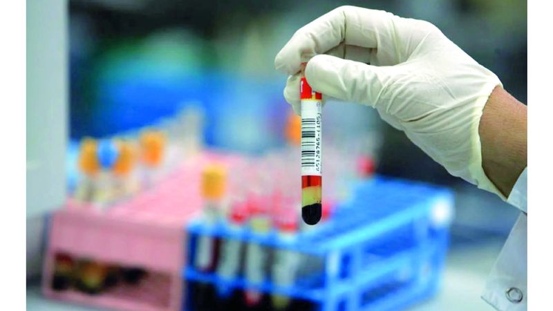 الامارات | علماء يكتشفون فصيلة دم جديدة «غير معروفة» سابقاً