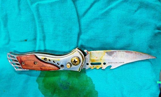 جراحة دقيقة تنقذ حياة طفل من طعنة قاتلة بالقلب بمستشفى سوهاج الجامعى.. صور