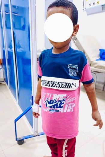 جراحة دقيقة تنقذ حياة طفل من طعنة قاتلة بالقلب بمستشفى سوهاج الجامعى.. صور