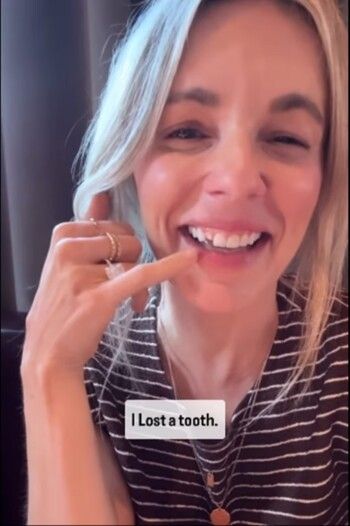 لحظة محرجة للغاية .. سقوط "سنّ" نجمة برنامج الواقع أثناء العشاء مع أصدقائها