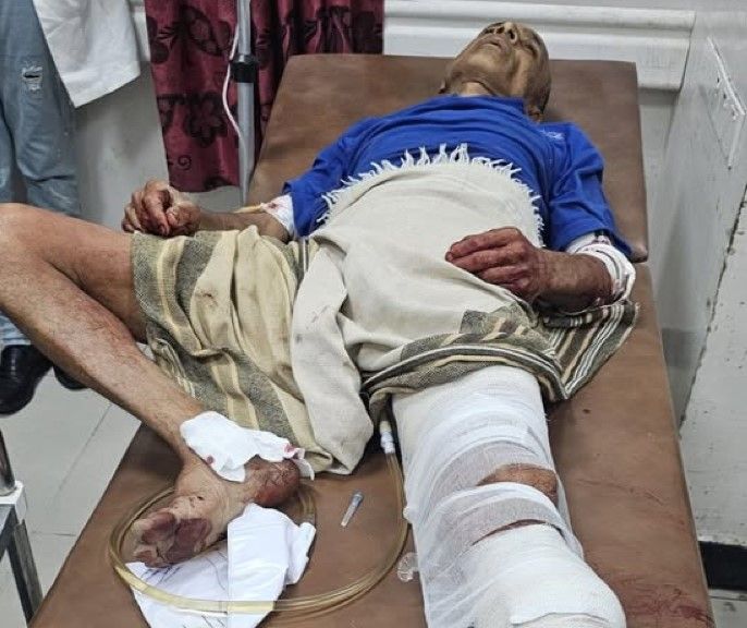 تعز.. قناص حوثي يستهدف مسنًا للمرة الثالثة جوار منزله شرق المدينة