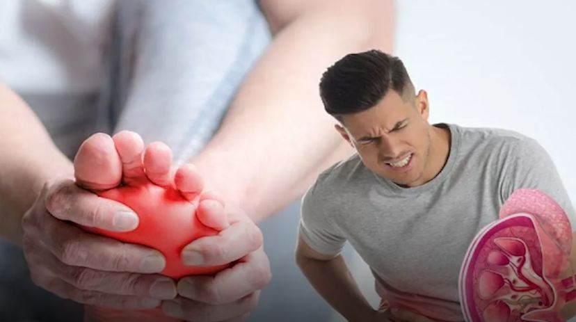 تحدث ليلًا...7 أعراض لحصوات الكلى تظهر على القدمين