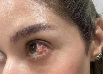 خطأ طبي وتدهور في الحالة الصحية لفنانة شهيرة