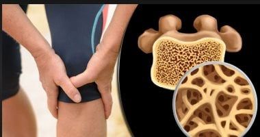لكبار السن.. 5 طرق لزيادة كثافة العظام والحفاظ عليها