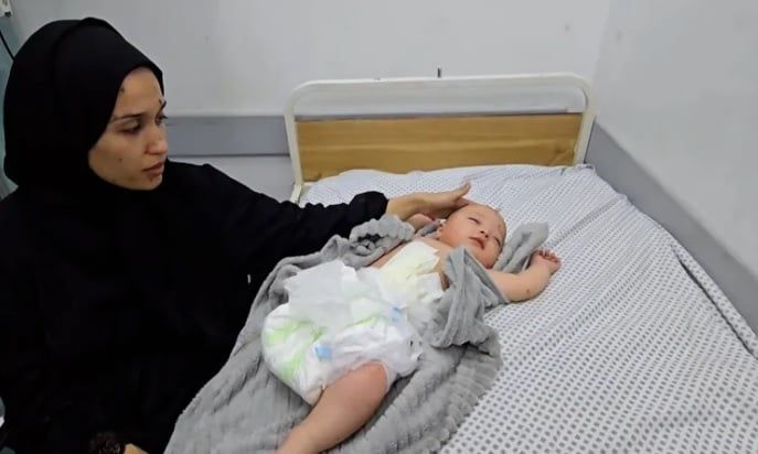 مشهد يهز القلوب.. بتر ساق رضيع فلسطينى بسبب غارة إسرائيلية على غزة.. صورة