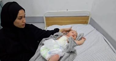 مشهد يهز القلوب.. بتر ساق رضيع فلسطينى بسبب غارة إسرائيلية على غزة.. صورة