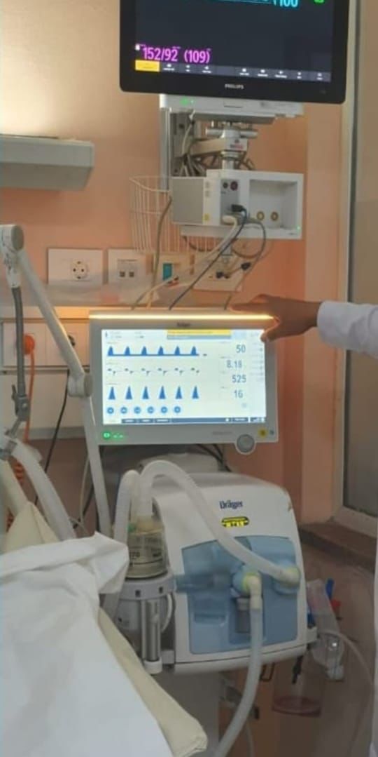 جامعة القاهرة تعلن تصنيع "EZVent" أول جهاز تنفس صناعى مصرى بالكامل