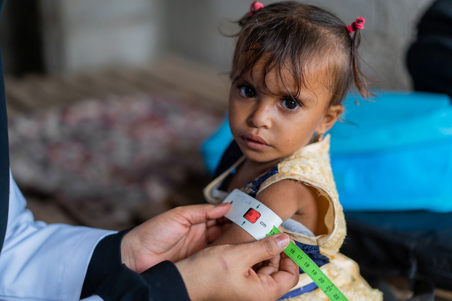 الغذاء العالمي: اليمن دخل مستويات قياسية من الحرمان الغذائي