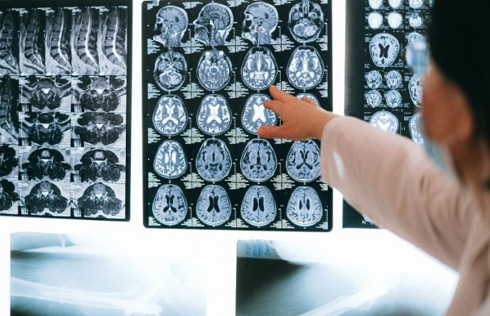 تكنولوجيا: أداة ذكاء اصطناعى تكتشف 9 أنواع من الخرف من فحص واحد بدقة 88%