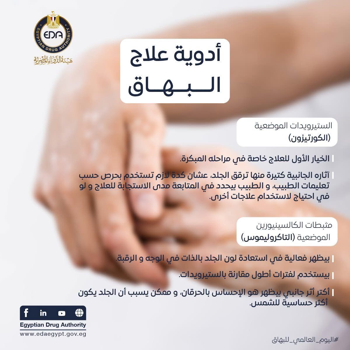 هيئة الدواء تكشف معلومات هامة عن مرض البهاق وطرق علاجه