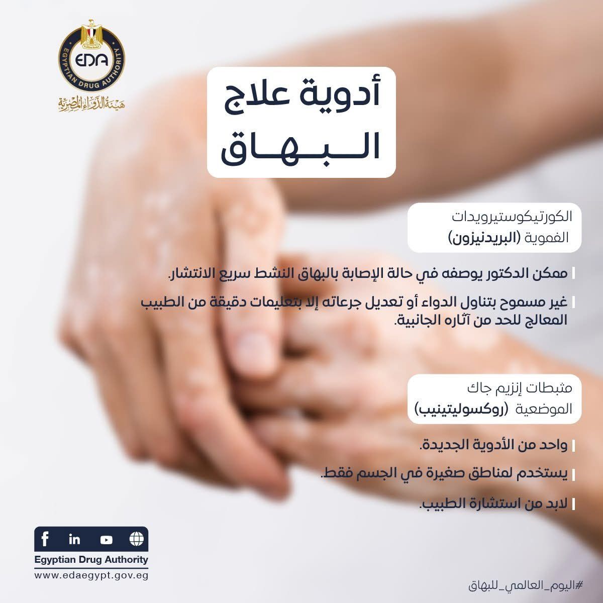 هيئة الدواء تكشف معلومات هامة عن مرض البهاق وطرق علاجه