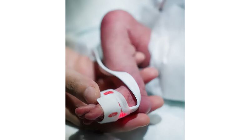 الامارات | بعد 70 يوماً على الأوكسجين.. الطفلة «روضة» تنتصر على تحديات صحية معقدة