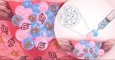 تطوير "ضمادة الجروح الذكية".. تعالج الالتهاب وتشفى الجروح بسرعة