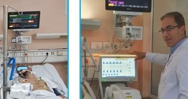 "معلومات الوزراء" يكشف تفاصيل أول جهاز تنفس صناعى مصرى محلى الصنع بالكامل