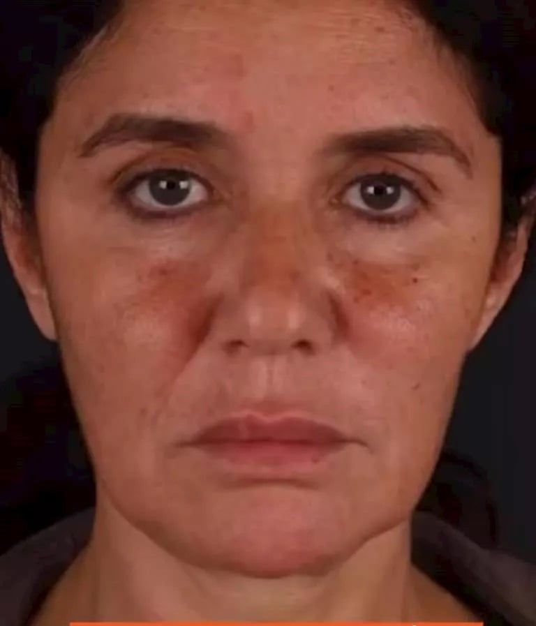 غادة عادل بعد خضوعها لعملية شد وجه.. ماذا تغير فى شكلها قبل وبعد؟