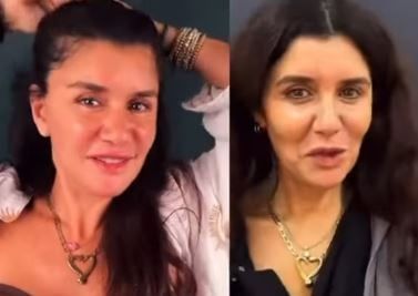 غادة عادل بعد خضوعها لعملية شد وجه.. ماذا تغير فى شكلها قبل وبعد؟