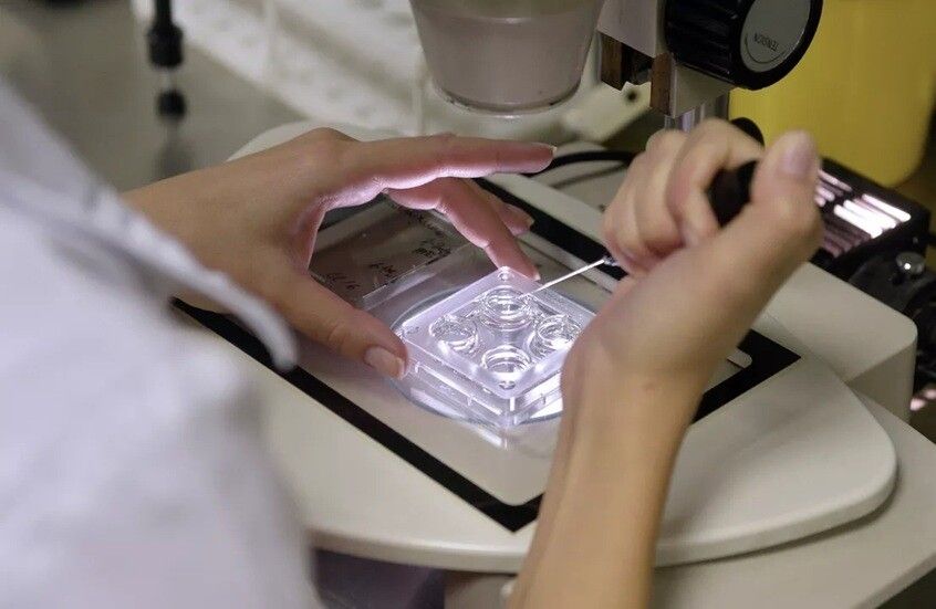 توأم أسود لأسرة بيضاء.. وخيانة زوجية تبطلها "مصاصة"!