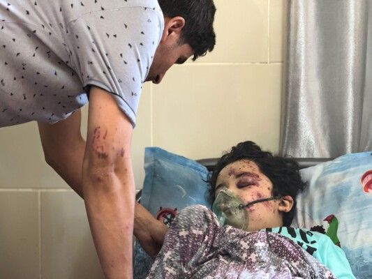 استبيان لـ"أطباء بلا حدود" في غزة: الأطفال يشكّلون قرابة نصف الضحايا