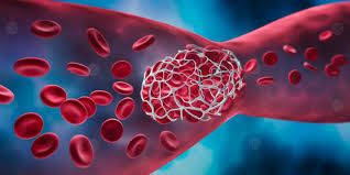 يقيه من الجلطات والذبحة الصدرية...استشاري يكشف عن أهم فحص لمن وصل إلى سن الـ 50 عاماً