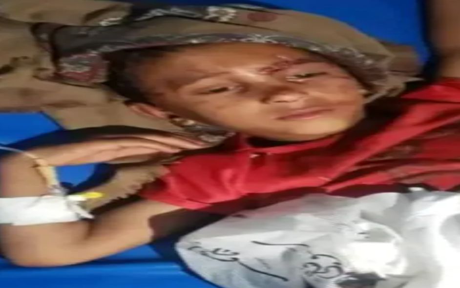 صور مرعبة .. ضبع يحاول افتراس طفلًا في إب والأهالي يتدخلون لإنقاذه