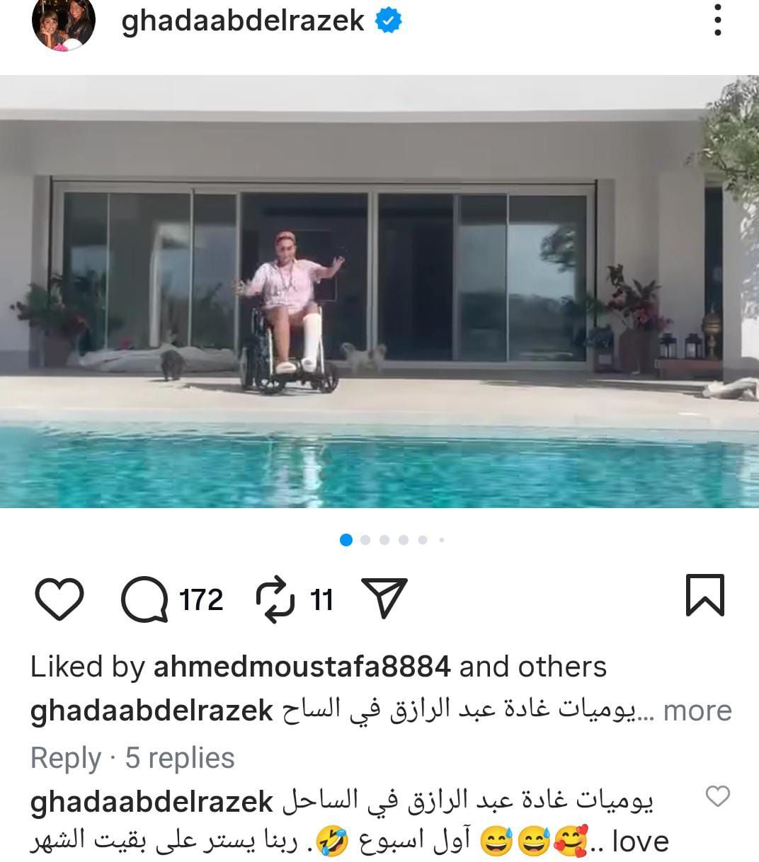 غادة عبد الرازق تكشف عن تعرضها للإصابة وتجلس على كرسى متحرك