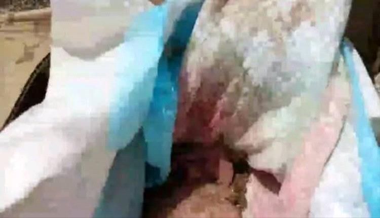 كشفتهم امرأة مسنة...ذبحوا رضيعة ودفنوها في كرتون خلف مستشفى بالضالع "تقشعر لها الأبدان"