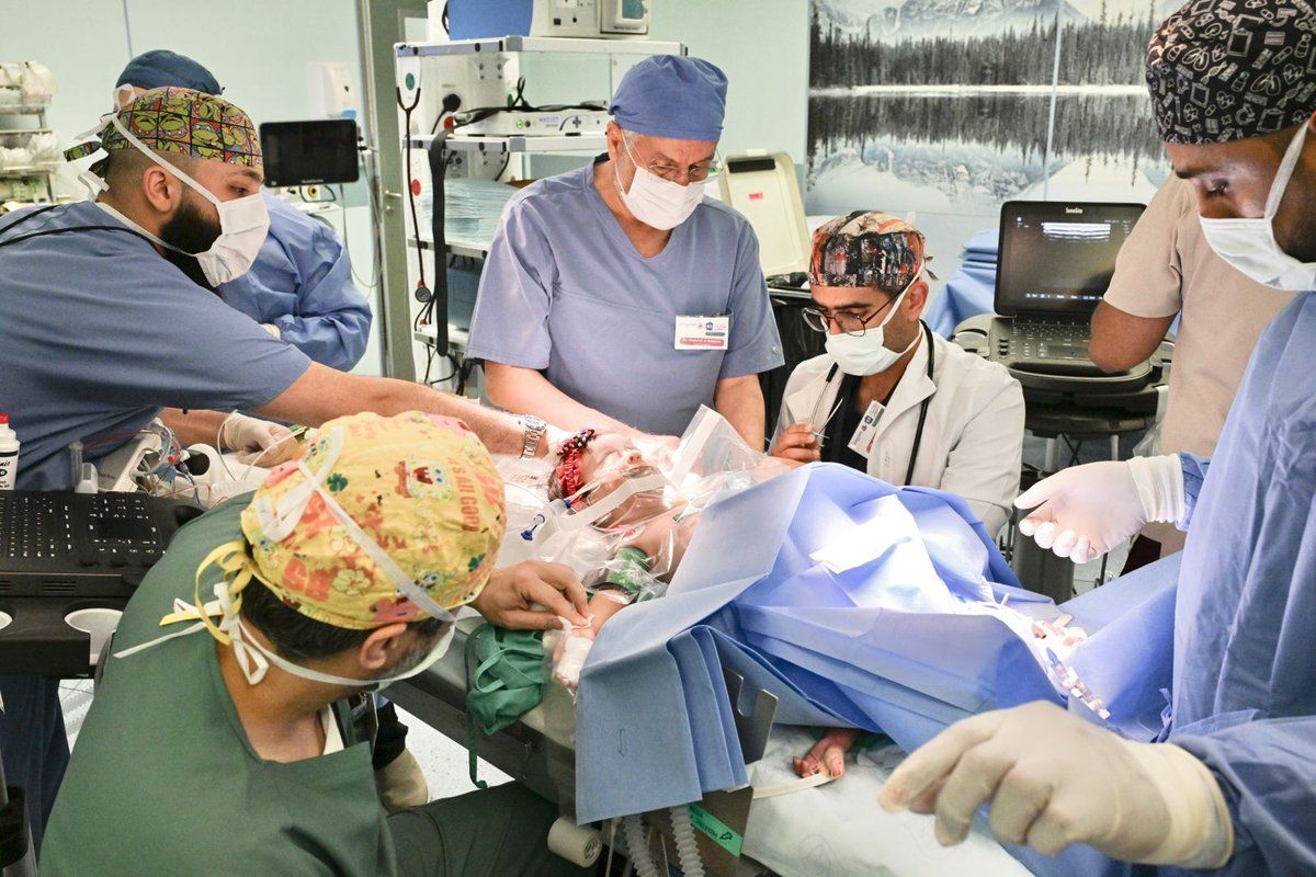 بدء عملية فصل التوأم الملتصق السعودي.. صور